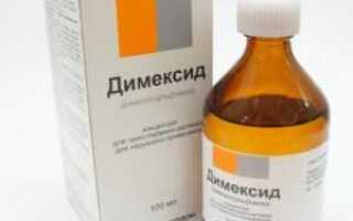 Чем отмыть линолеум после ремонта от грунтовки и побелки