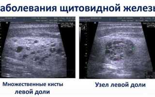 Как выглядит узо в щитке фото