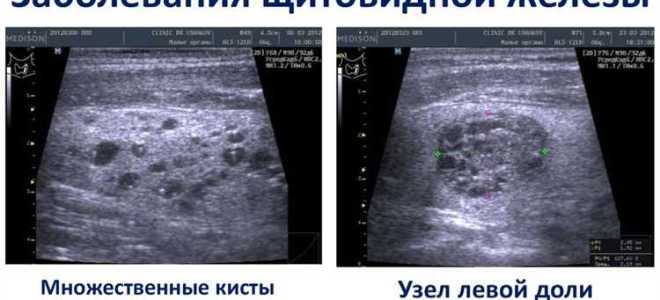 Как выглядит узо в щитке фото