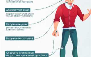 Форум сколько ваши родственники были после инсульта