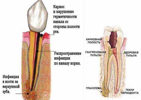 Методы измерения влажности древесины в срубе