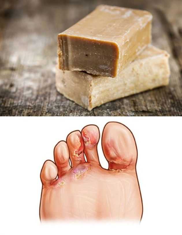 Что растворяет мыло лучше всего Что растворяет мыло лучше всего