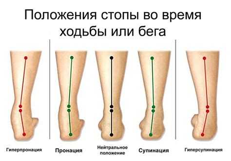 Можно ли укрепить задник с помощью подручных средств