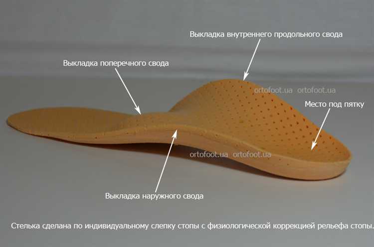Какие модели обуви чаще всего вызывают сползание стелек