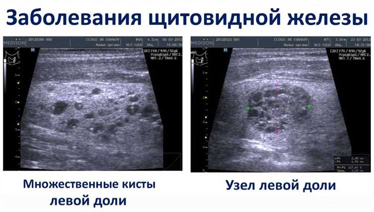 Как выглядит узо в щитке фото