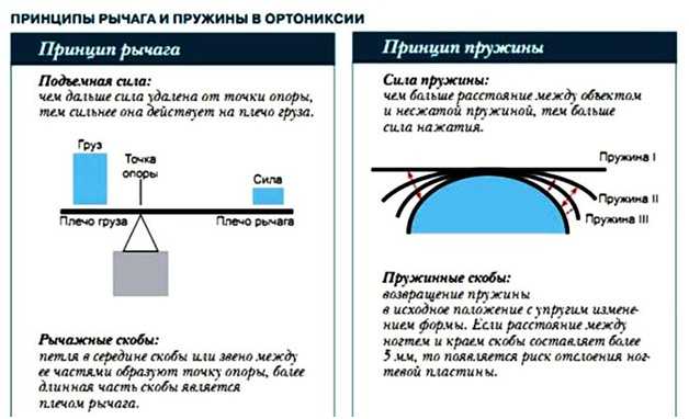Методы корректировки техники для уменьшения нитей воска