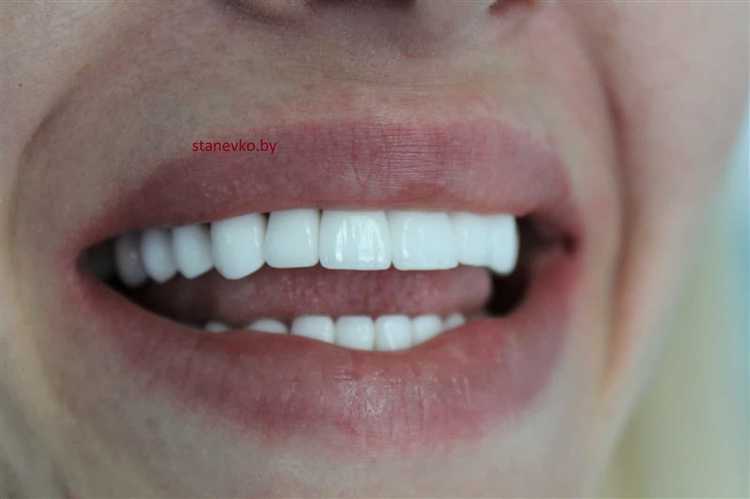 Разница в стоимости между клиниками по мнению пациентов