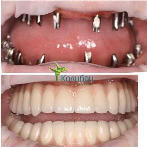 Как пациенты оценивают соотношение цены и результата